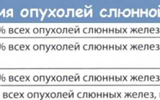 Аденома околоушной слюнной железы код мкб