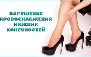 Синдром нарушения кровообращения в нижних конечностях