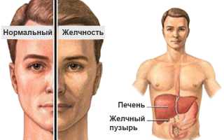 Синдром жильбера к какому врачу идти
