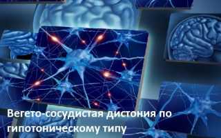 Что такое синдром дистонии по гипотоническому типу