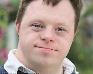 Что такое риск синдрома дауна
