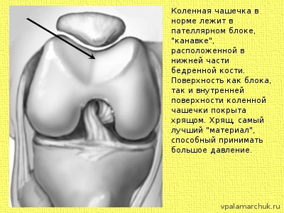 пателлофеморальное сочленение