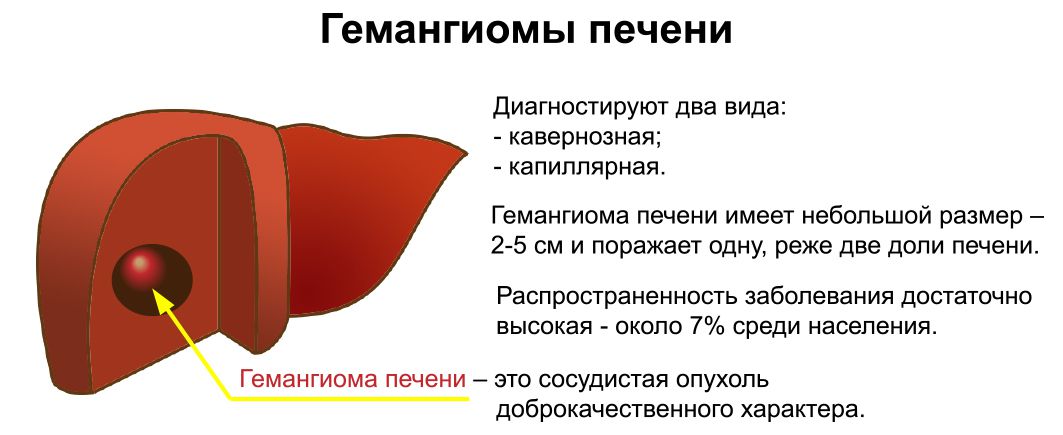 Зно органов брюшной полости код по мкб 10