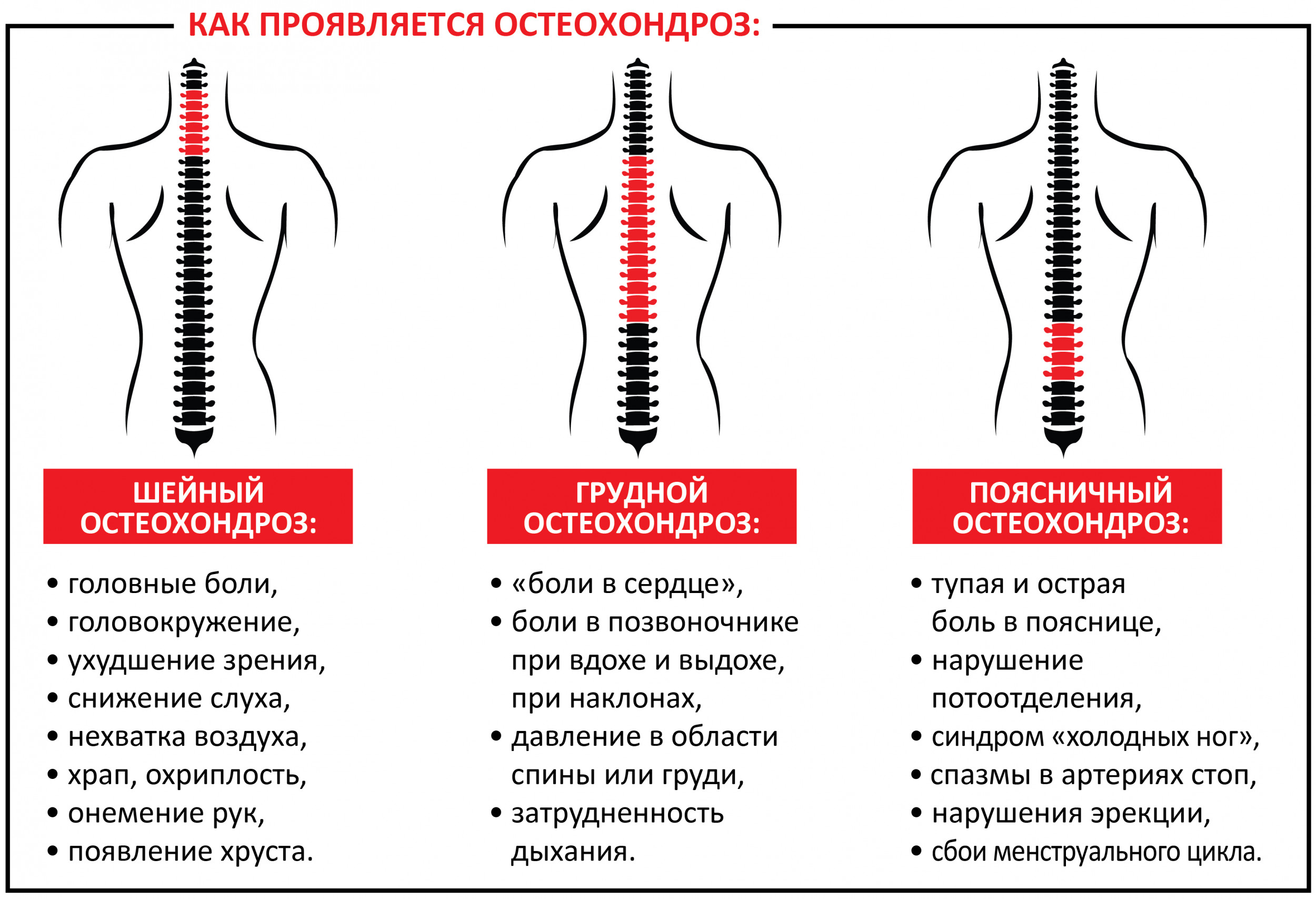 Как проявляется остеохондроз