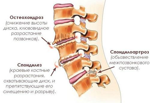 Причины боли в позвоночнике